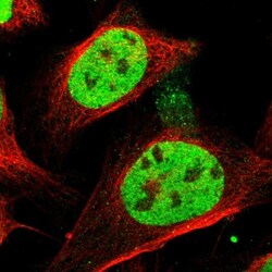 SFRS15 Antibody, Novus Biologicals 0.1mL; Unlabeled:Antibodies, Polyclonal